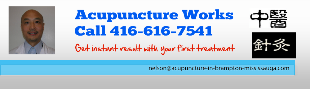 Acupuncture in Brampton, Mississauga